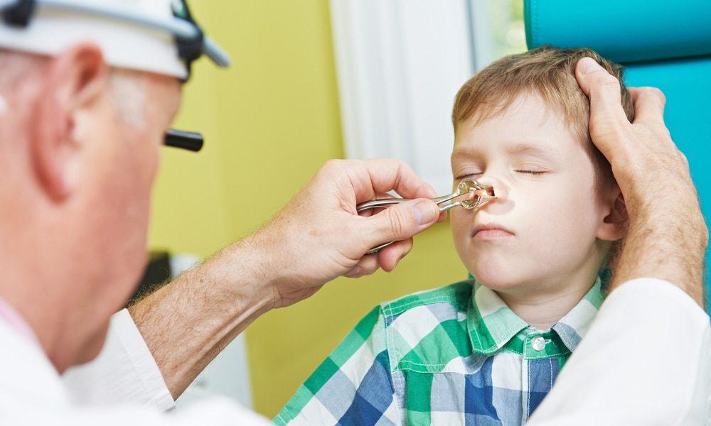découvrez tout ce qu'il faut savoir sur la chirurgie du septum dévié : méthodes, avantages, récupérations et conseils pour améliorer votre respiration et votre qualité de vie.