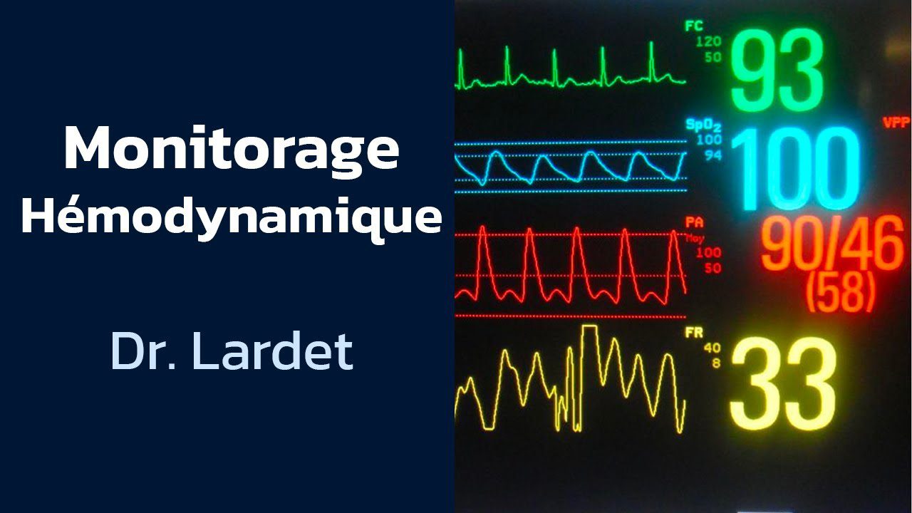découvrez les meilleures pratiques de monitorage pour optimiser la performance de vos systèmes. suivez en temps réel les données clés pour garantir la sécurité et l'efficacité de vos opérations.