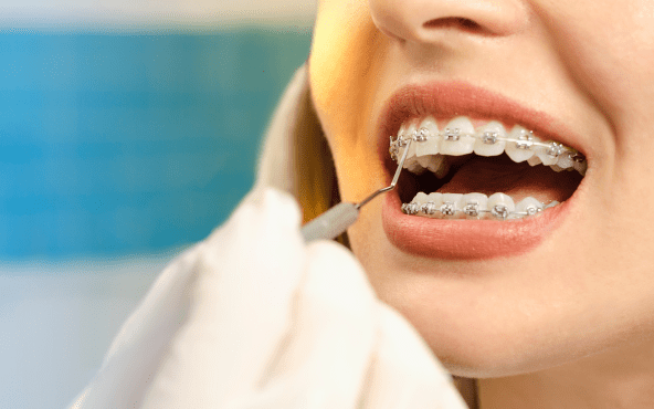 obtenez un devis dentiste gratuit en quelques clics. comparez les tarifs et les services des dentistes près de chez vous pour des soins dentaires adaptés à vos besoins et à votre budget.